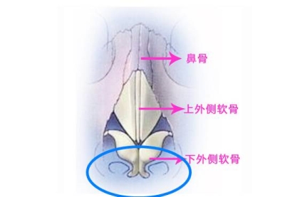 隆鼻后能不能揉呢-艺星隆鼻医生为您介绍