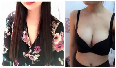 女性产后乳房下垂的原因是什么