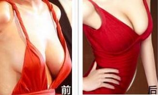 女性产后乳房下垂的原因是什么