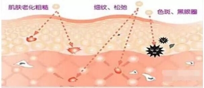 【北京艺星】色斑是如何形成的？你对色斑的了解有多少